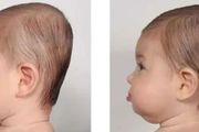 想讓孩子有一個漂亮的頭型，如何預防和治療偏頭與扁頭？