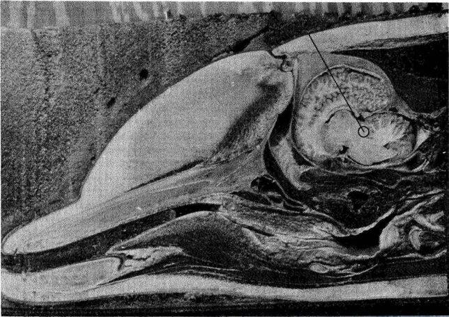 齒鯨類用於回聲定位的瓜器官