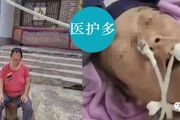 河北醫生假冒北京專家飛刀手術，被吊銷執照！