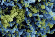 德國最新臨床研究：輝瑞mRNA新冠疫苗可能引發「神秘肝炎」