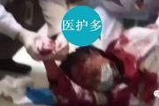 中國警方通報彭醫生被砍事件！管床醫生站出發聲