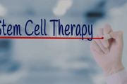 NBE：刷新認知！千辛萬苦做的幹細胞治療，竟只為「一死」！