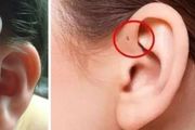 為什麼我的耳朵邊有個小洞？不會病變吧？