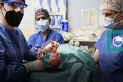 首位豬心移植患者去世！術後存活2個月，創造醫學裡程碑