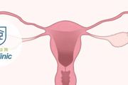 體檢發現卵巢增大，怎麼辦？