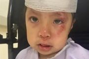 女孩法拉盛當街遭暴徒扔出嬰兒車，還被踢打，鼻青眼臉腫，血流滿面…